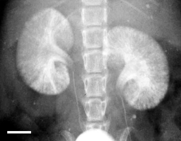 [AuroVist imaging mouse kidneys (60k)]