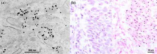 [GoldEnhance: TEM labeling and ISH Visualization vs. DAB (126k)]