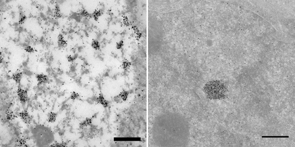 [Nanogold-IgG in vivo labeling results - electron micrographs (82k)]