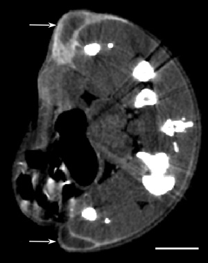 MicroCT section of mouse with two subcutaneous tumors (one one each leg, arrows) showing AuroVist-15 nm uptake 20 hours after intraveneous injection.  Bar = 5 mm.</p>       </p>            </p>