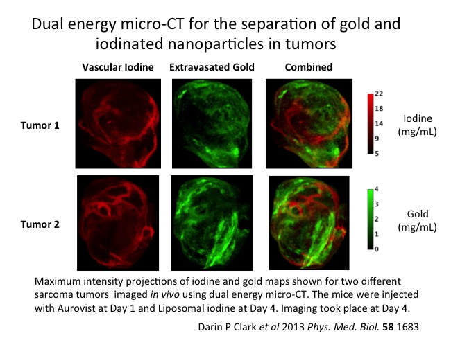 AuroVist gold nanoparticles and iodine create direct visualizations of tumor growth with micro-CT.