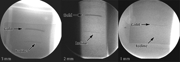 Imaging of gold vs. iodine reagents in simulated blood vessels (glass capillaries). Polystyrene was used to emulate tissue thickness, typical of a large or obese patient receiving a fluoroscope examination. 