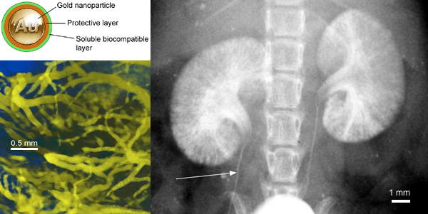 (Upper left) Gold nanoparticle with ligand shell showing protective layer to isolate gold from physiological interactions and highly soluble, biocompatible outer layer.   (Lower left) High-resolution microCT with AuroVist-15 nm: blood vessels in a live mouse around legs and pelvic region after IV injection of AuroVist-15 nm.   (Right) Kidney imaging, showing how clearance through the kidneys facilitates detailed imaging: Planar X-ray image of kidneys in live mouse after IV injection of AuroVist-1.9 nm gold nanoparticles. Arrow: 100 m ureter.
