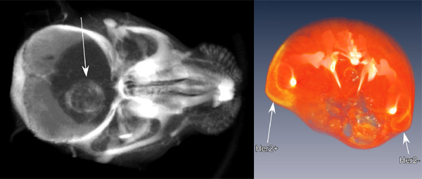 Tumor imaging with AuroVist™: (Left) Brain tumor in mouse imaged by microCT after intraveneous injection of AuroVist™ 15nm. (Right) Protoype of a targeted AuroVist™: MicroCT section from mouse bearing Her2-positive (left arrow) and Her2-negative tumors (right arrow) growing in opposite thighs, 20 hours after intraveneous injection of Herceptin-linked AuroVist™-15nm. The reagent preferentially targets the Her2-positive tumor, producing higher contrast.