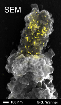 Scanning electron micrograph of peg-like terminal constriction of Oziroë biflora (plant, Hyacinthaceae) chromosome, showing both chromosome topography (secondary electron signal) and hybridized enhanced gold signals (superimposed back-scattered electron signals, yellow) labeling of 45S rDNA in the nucleolus organizing region with Alexa Fluor 488 FluoroNanogold™-Streptavidin (courtesy of Elizabeth Schroeder-Reiter and Gerhard Wanner).