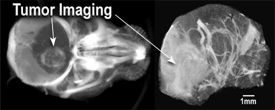 MicroCT of brain of live mouse after IV injection of AuroVist-15 nm. 
 Tumor stands out (white density) due to penetration of AuroVist-15 nm
through the compromised blood-brain-tumor barrier.
Right:  Skull computationally removed revealing brain vasculature.