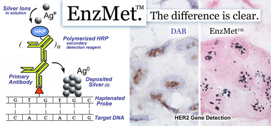 The mechanism of EnzMet SISH technology, with DAB comparison in HER2 breast cancer tissue assay.