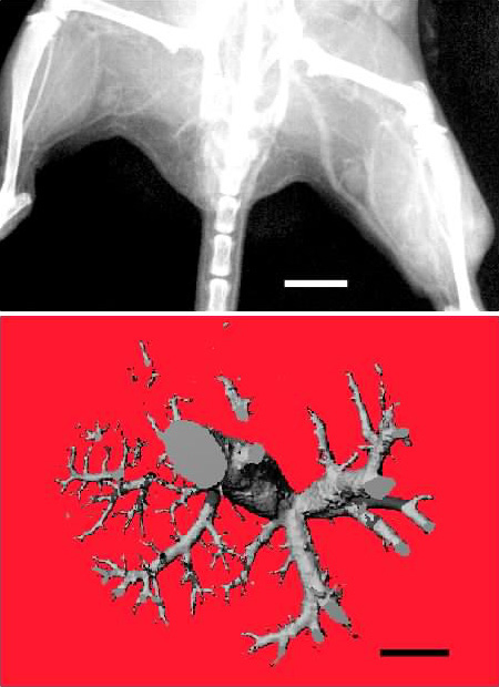 AuroVist shows vascular fine structure [(93k)]