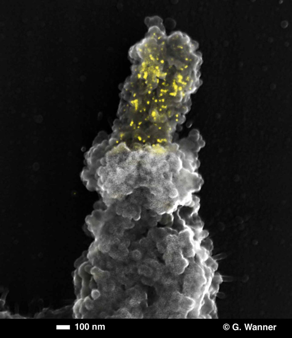 [Correlative Fluorescence and SEM with FluoroNanogold] (94k)]