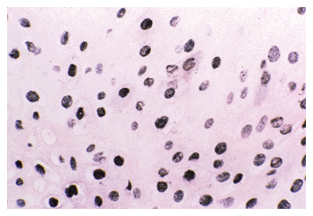 Nanogold-Streptavidin In Situ labeled section (65k)