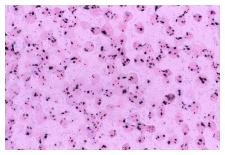 Nanogold-Streptavidin labeled section in conjunction with CARD (71k)