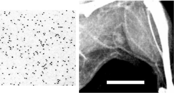 [Fig. 1 and 2: EM of 1.9 nm Gold and X-ray radiograph of injected mouse leg] (91k)