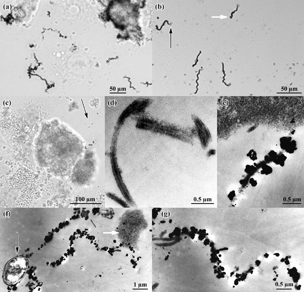 [Fig. 1: Enzyme Metallography Light and EM Images] (151k)