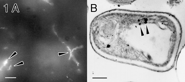 Figure 1: Micrographs (55k)