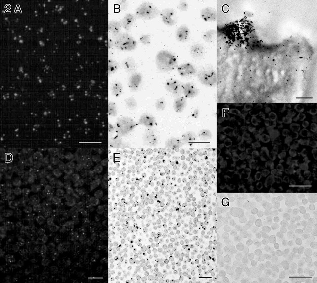 Figure 2: Micrographs (133k)