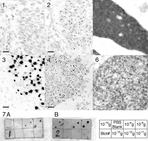 Figures 1-7: Micrographs and Blots (141k)