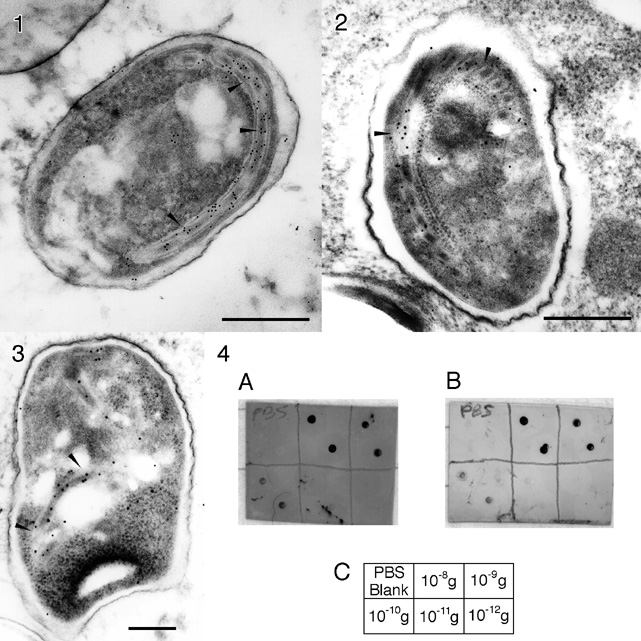 Figures: Micrographs and Blot (145k)