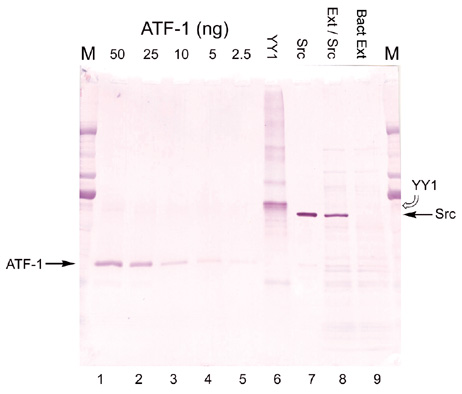 [Western blot developed with GoldiBlot (33k)]