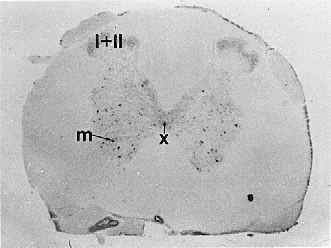 [Micrograph] (77k)