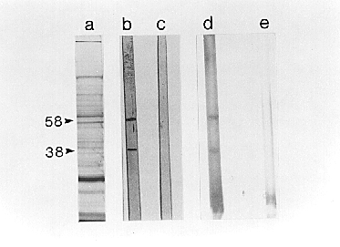 [gel photo] (76k)