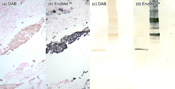 EnzMet™ for IHC and Western Blot: comparison with DAB