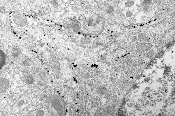 [Pre-embedding labeling with Nanogold-Fab' and HQ Silver (133k)]