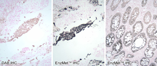 [EnzMet for IHC (83k)]