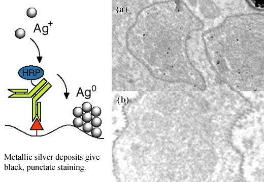 [Enzyme Metallography: Mechanism and Electron Microscopy] (68k)]