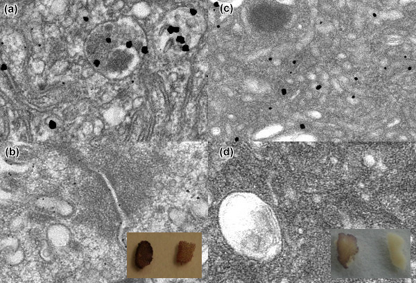 [Effect of modifications to control background staining with gold enhancement (155k)]