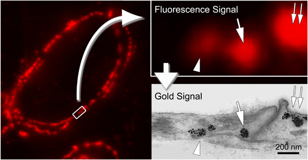 [Correlative Alexa Fluor 594 FluoroNanogold Labeling (67k)]