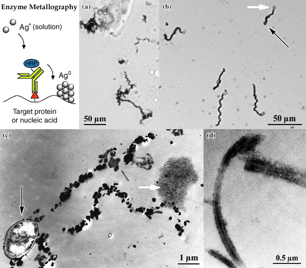 [Enzyme Metallography: LM and EM of Microsporida (130k)]