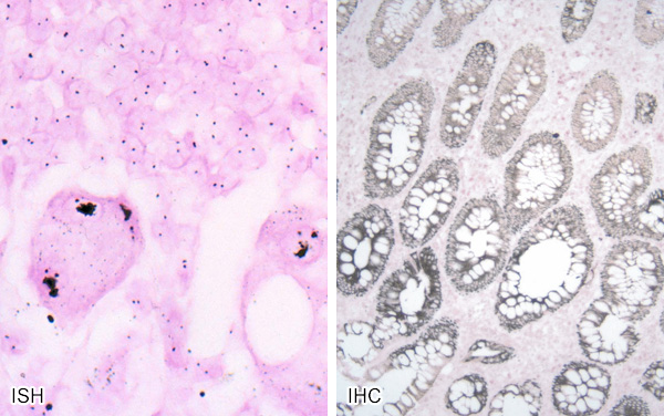 [EnzMet ISH and IHC examples (111k)]