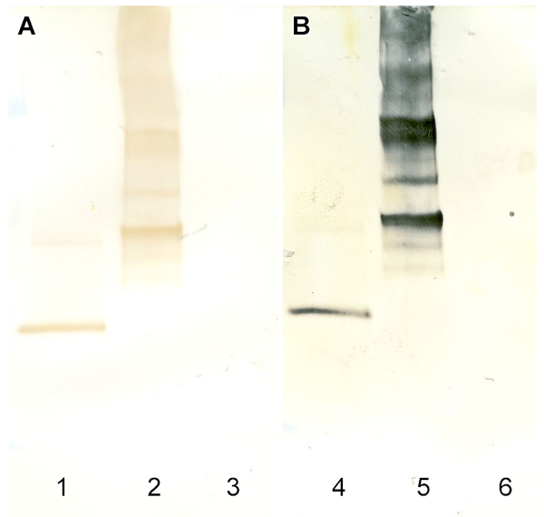 [DAB vs. EnzMet Western Blot (78k)]