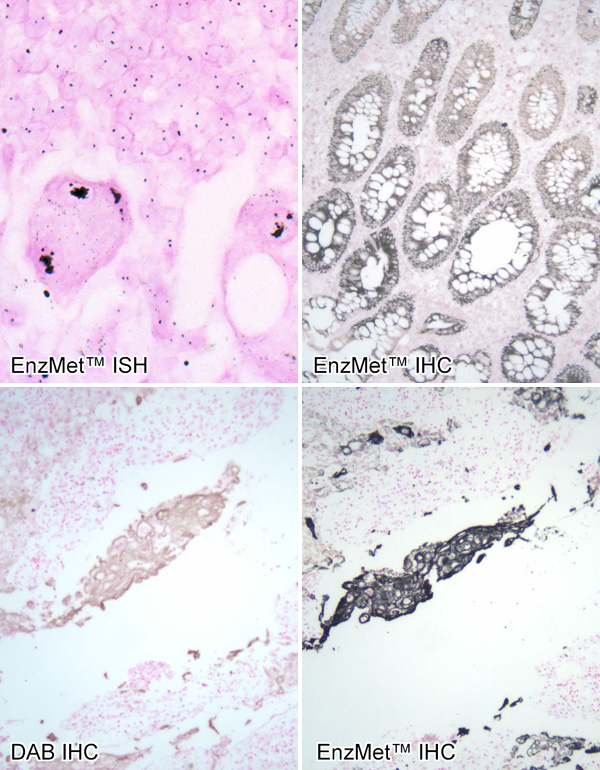 [EnzMet: ISH, IHC, and comparison with DAB (208k)]