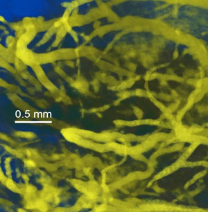 High resolution vascular imaging of blood vessels in a live mouse after iv injection of AuroVist-15.