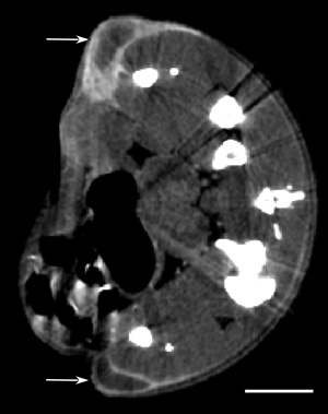 MicroCT section of mouse with two subcutaneous tumors (one one each leg, arrows) showing AuroVist™-15 nm uptake 20 hours after intraveneous injection. Bar = 5 mm.</p> </p> </p>