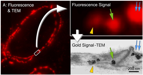 Correlative fluorescence and EM image of caveolin labeled with Alexa Fluor 594 FluoroNanogold™-Streptavidin