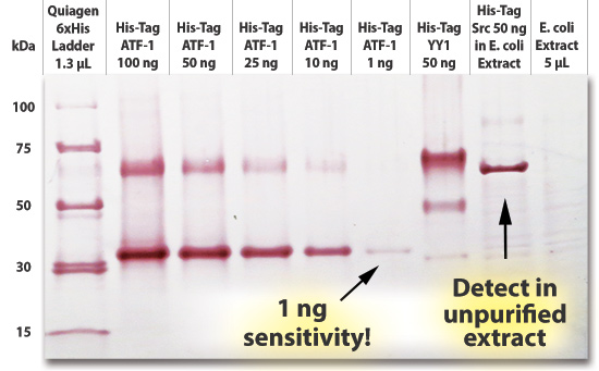 Western blot showing detection of His-tagged ATF and YY1 proteins using GoldiBlot