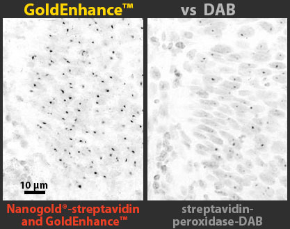 GoldEnhance LM example (44k)