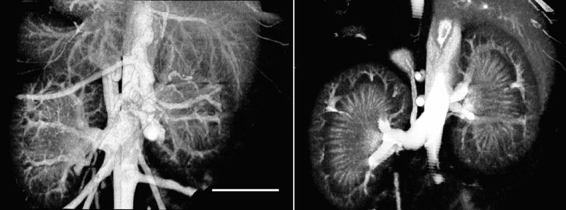 MicroCT of circulatory system and kidneys of live mouse after IV injection of VivoVist