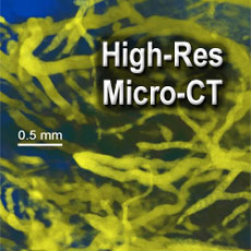 20µm blood vessels in a live mouse around legs and pelvic region after IV injection of AuroVist™-15nm. 