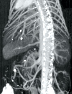 In vivo micro-CT of mouse after injection with AuroVist 15 nm x-ray contrast agent.